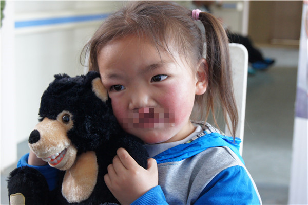 楊元波（男）術前照 （2014）（嘴部馬賽克）.jpg